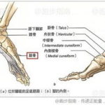 脚跟骨刺的治疗方法,综合疗法与日常护理